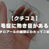 美容師が解説！抜毛症に効き目がある？トリコチロアールの【クチコミ】細部にわたってご紹介！！