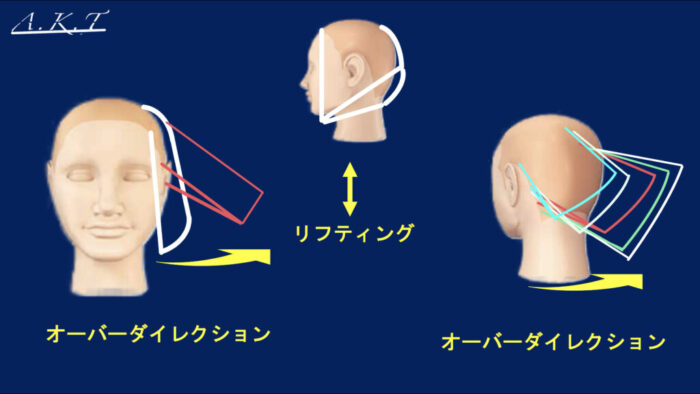 リフティング・オーバダイレクション