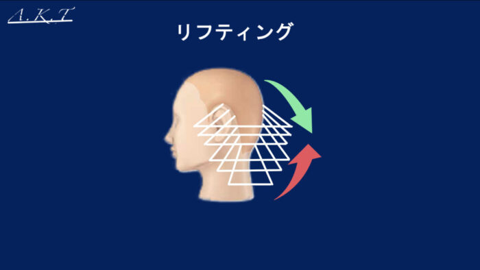 リフティング・オーバダイレクション