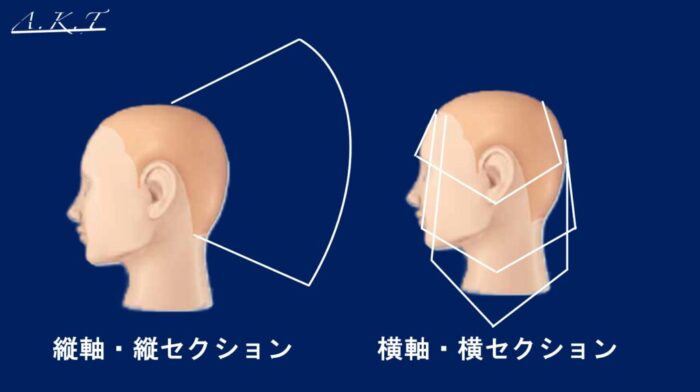ヘアスタイルのひし形の理解・バランス